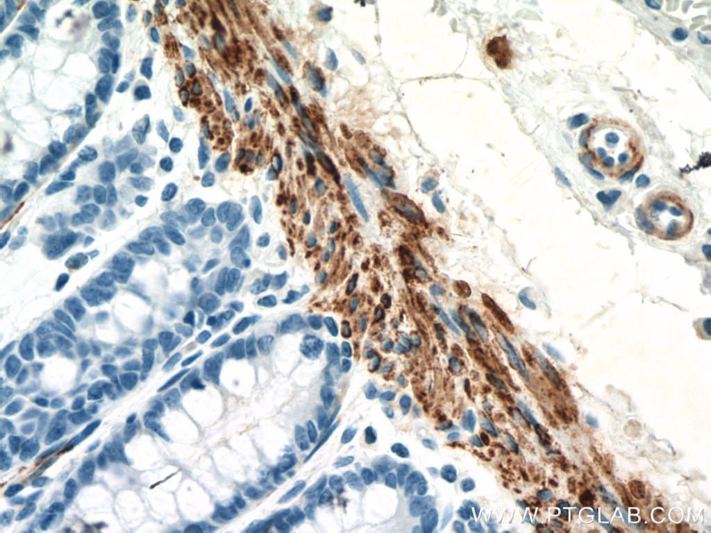 Immunohistochemistry (IHC) staining of human colon tissue using Desmin Polyclonal antibody (16520-1-AP)