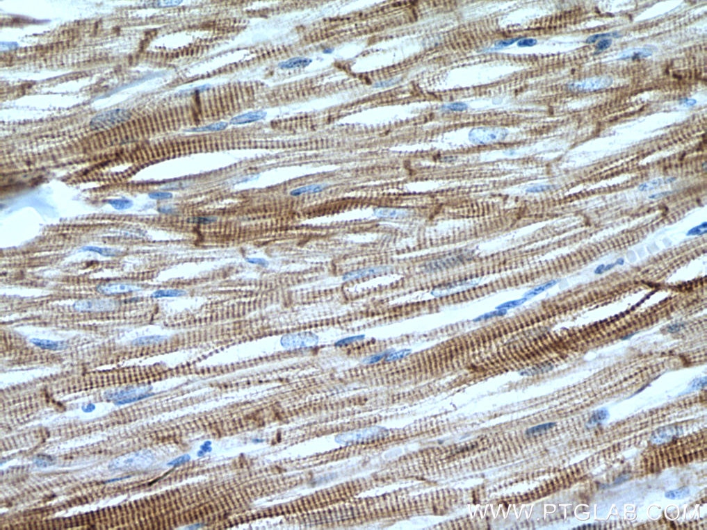 Immunohistochemistry (IHC) staining of human heart tissue using Desmin Polyclonal antibody (16520-1-AP)