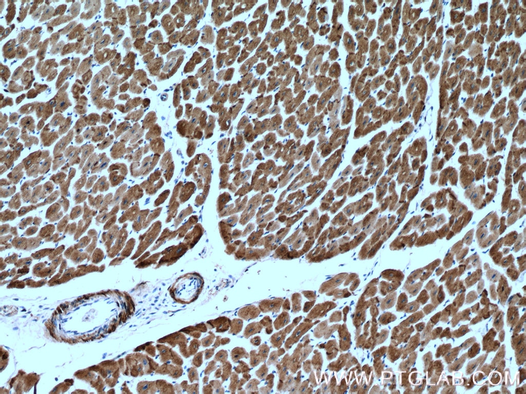 IHC staining of human heart using 16520-1-AP