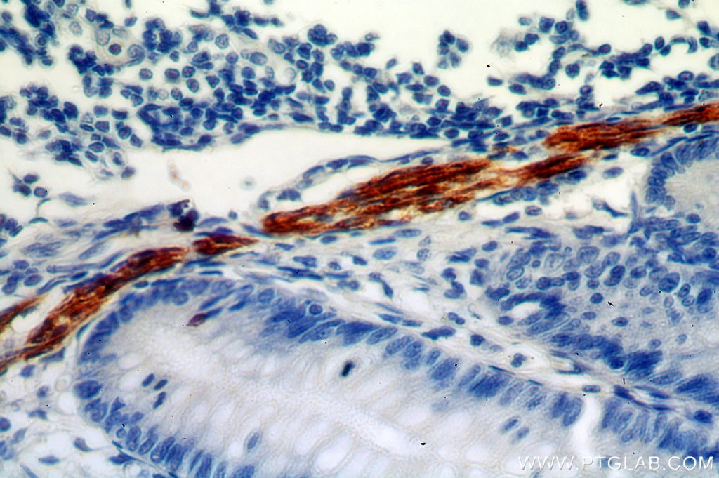 Immunohistochemistry (IHC) staining of human appendix tissue using Desmin Polyclonal antibody (16520-1-AP)