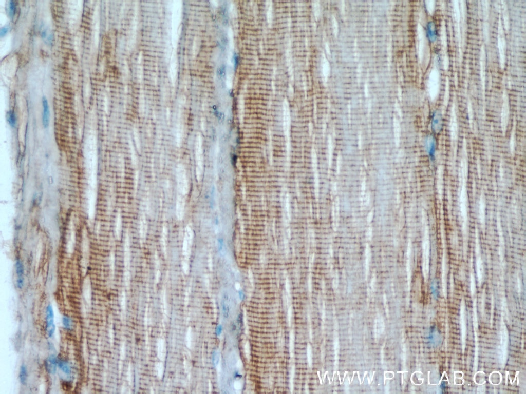 Immunohistochemistry (IHC) staining of human skeletal muscle tissue using Desmin Polyclonal antibody (16520-1-AP)