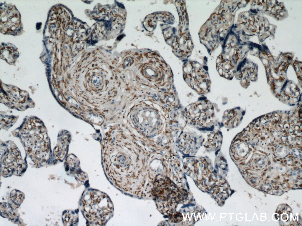 Immunohistochemistry (IHC) staining of human placenta tissue using Desmin Polyclonal antibody (16520-1-AP)