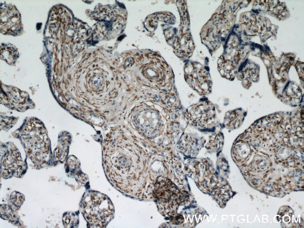 IHC staining of human placenta using 16520-1-AP