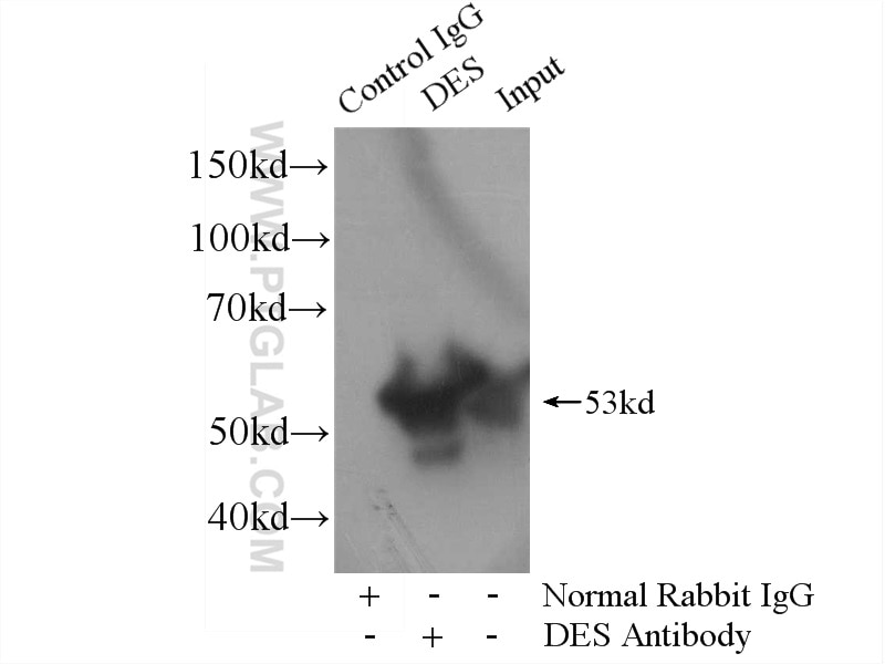 Immunoprecipitation (IP) experiment of mouse heart tissue using Desmin Polyclonal antibody (16520-1-AP)