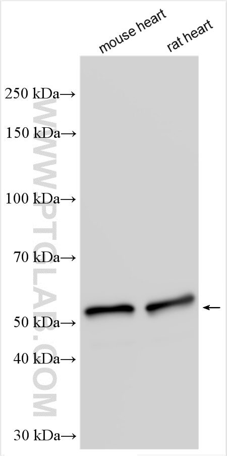 Western Blot (WB) analysis of various lysates using Desmin Polyclonal antibody (16520-1-AP)