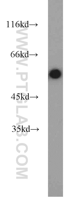 Western Blot (WB) analysis of human heart tissue using Desmin Polyclonal antibody (16520-1-AP)