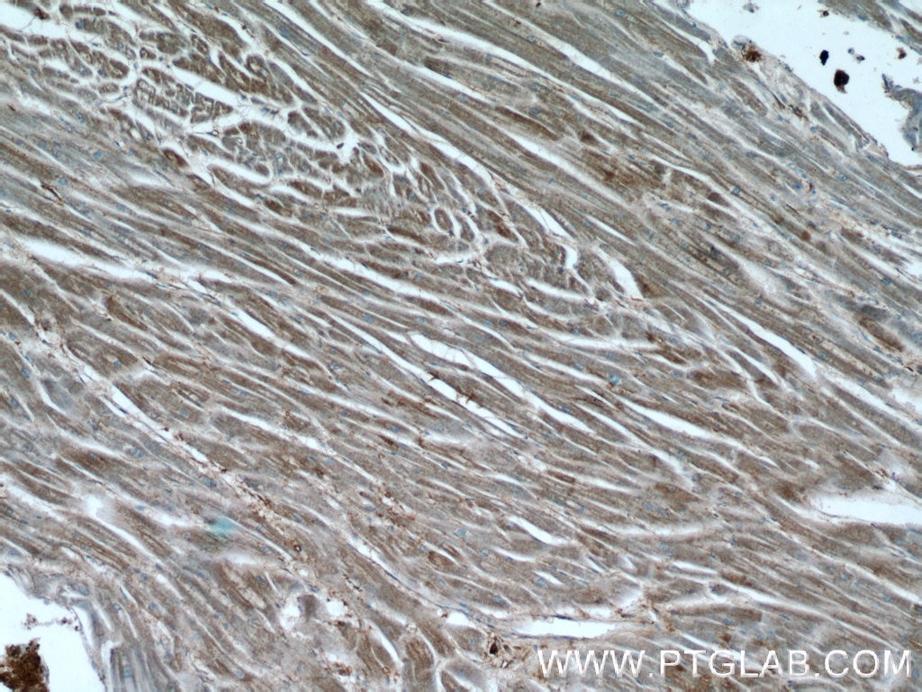 Immunohistochemistry (IHC) staining of human heart tissue using Desmin Polyclonal antibody (22205-1-AP)