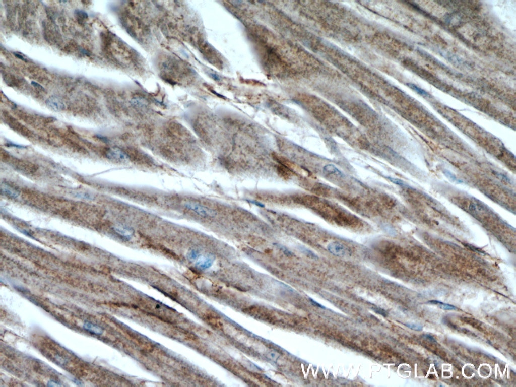 Immunohistochemistry (IHC) staining of human heart tissue using Desmin Polyclonal antibody (22205-1-AP)