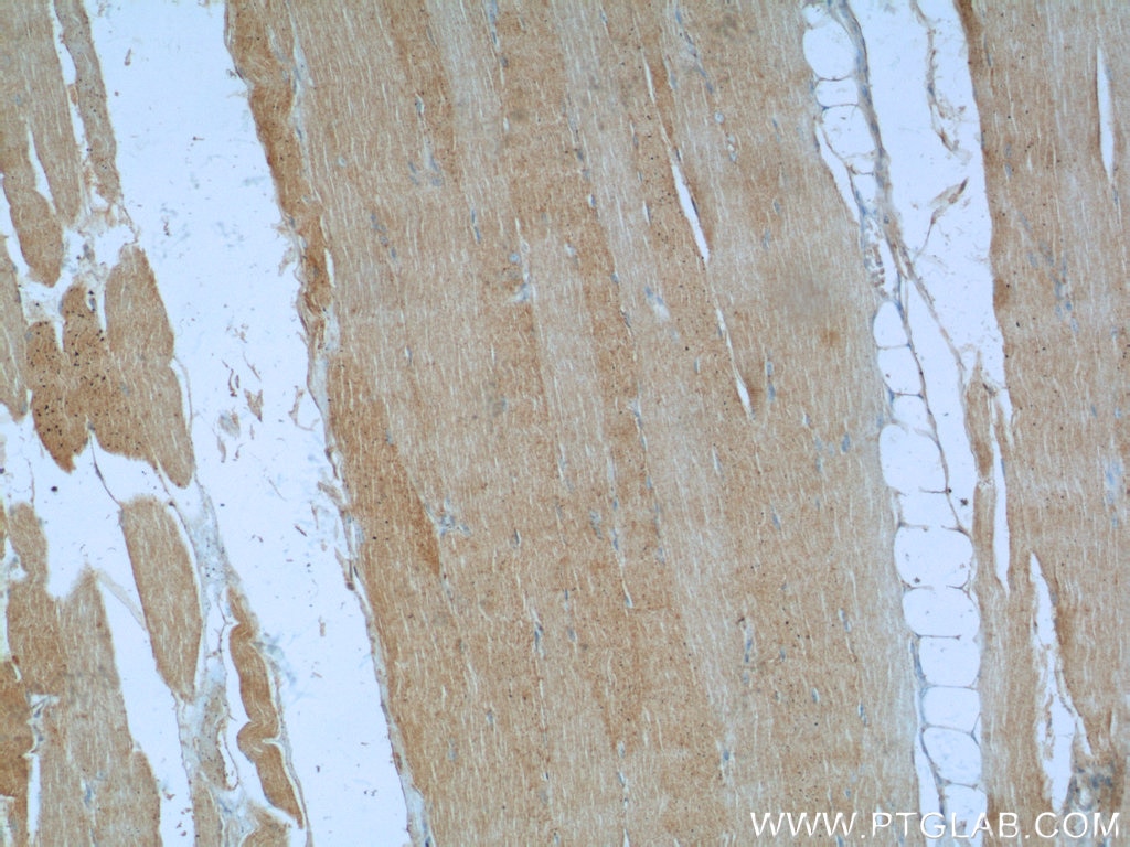 Immunohistochemistry (IHC) staining of human skeletal muscle tissue using Desmin Polyclonal antibody (22205-1-AP)