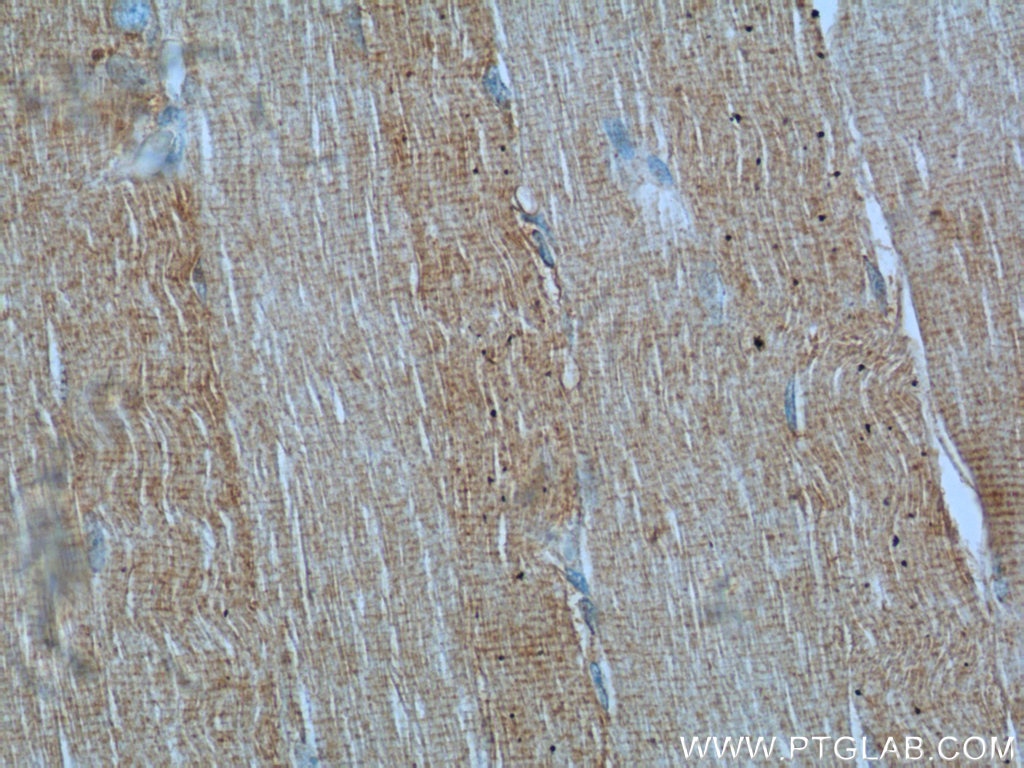 IHC staining of human skeletal muscle using 22205-1-AP