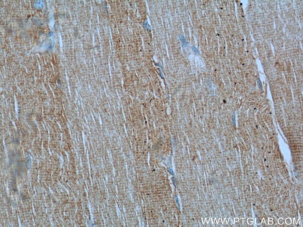 Immunohistochemistry (IHC) staining of human skeletal muscle tissue using Desmin Polyclonal antibody (22205-1-AP)