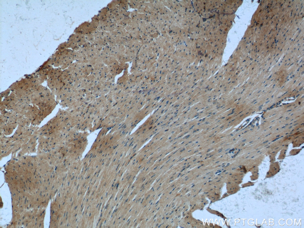 Immunohistochemistry (IHC) staining of mouse heart tissue using Desmin Polyclonal antibody (22205-1-AP)