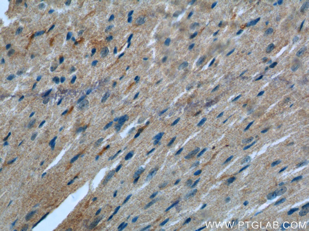 Immunohistochemistry (IHC) staining of mouse heart tissue using Desmin Polyclonal antibody (22205-1-AP)