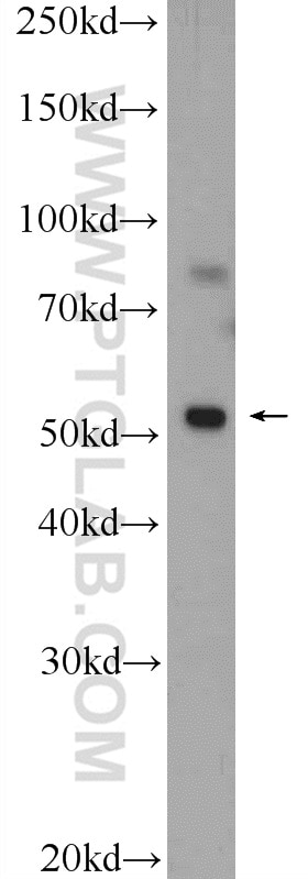 Western Blot (WB) analysis of mouse skeletal muscle tissue using Desmin Polyclonal antibody (22205-1-AP)