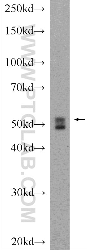 Western Blot (WB) analysis of rat skeletal muscle tissue using Desmin Polyclonal antibody (22205-1-AP)
