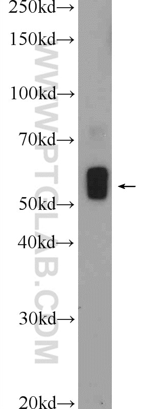 Western Blot (WB) analysis of mouse heart tissue using Desmin Polyclonal antibody (22205-1-AP)