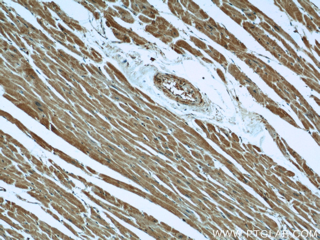 Desmin Monoclonal antibody