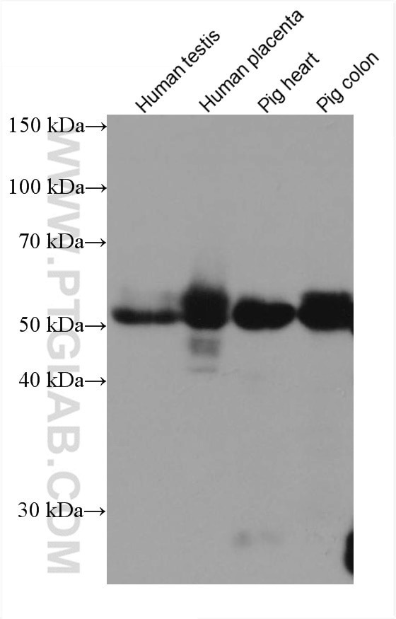 Western Blot (WB) analysis of various lysates using Desmin Monoclonal antibody (60226-1-Ig)