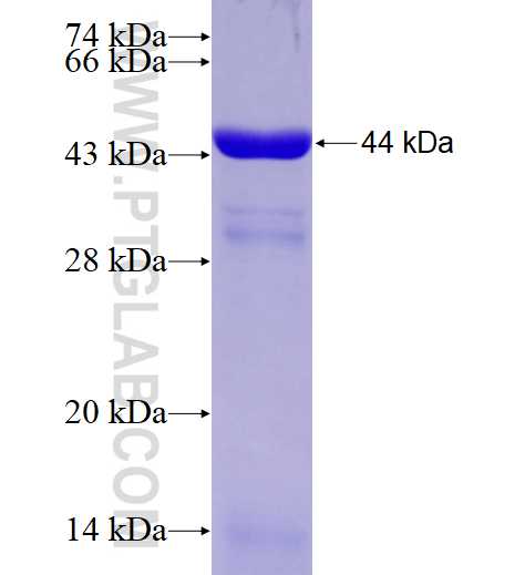 Desmin fusion protein Ag9675 SDS-PAGE