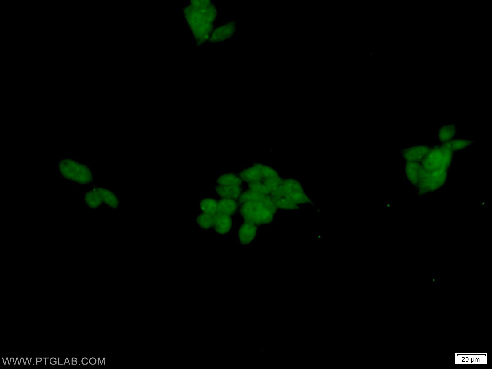 Immunofluorescence (IF) / fluorescent staining of HEK-293 cells using DFFA,DFF45 Polyclonal antibody (10191-2-AP)
