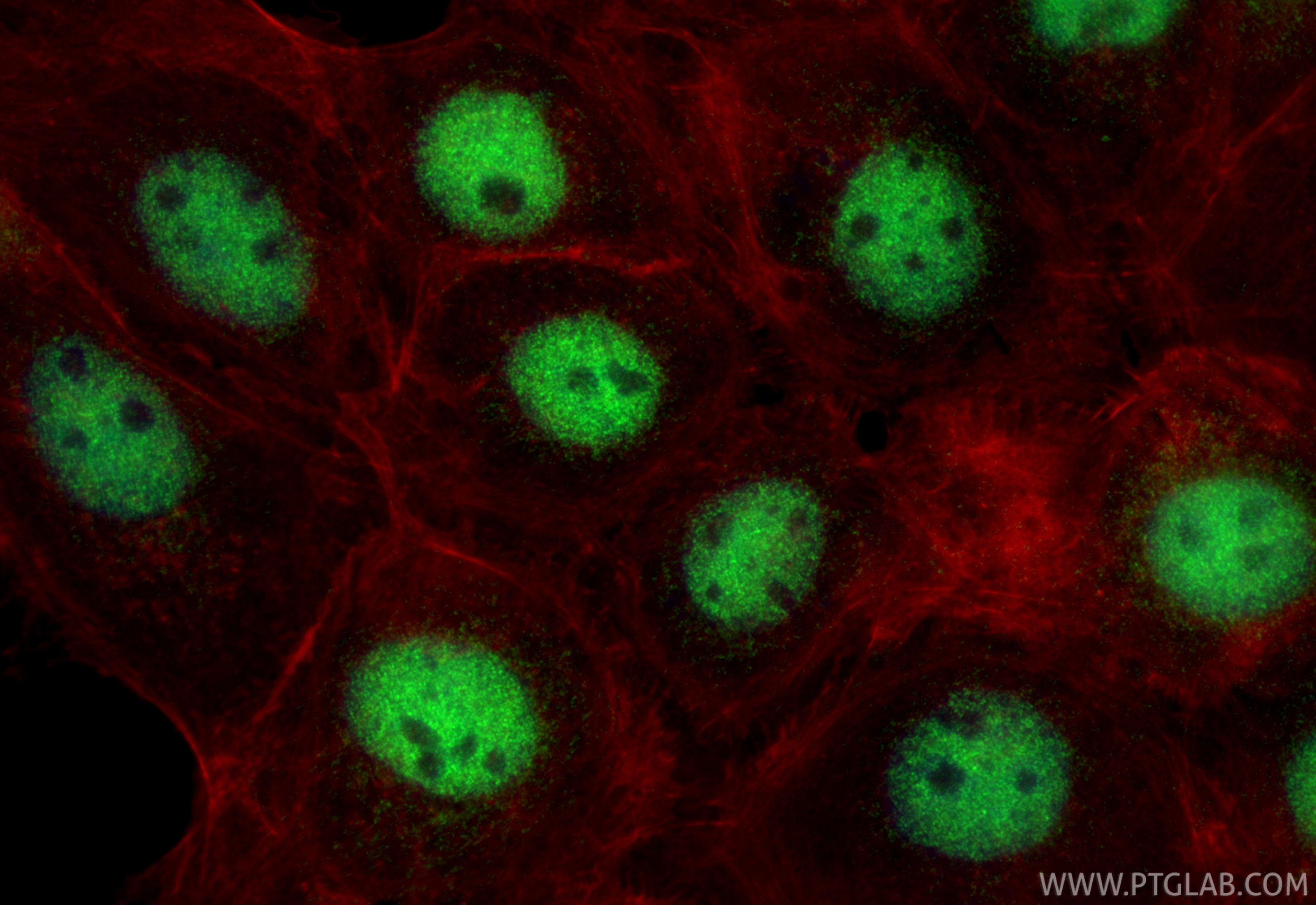 Immunofluorescence (IF) / fluorescent staining of A431 cells using DFFA/DFF45 Polyclonal antibody (10191-2-AP)