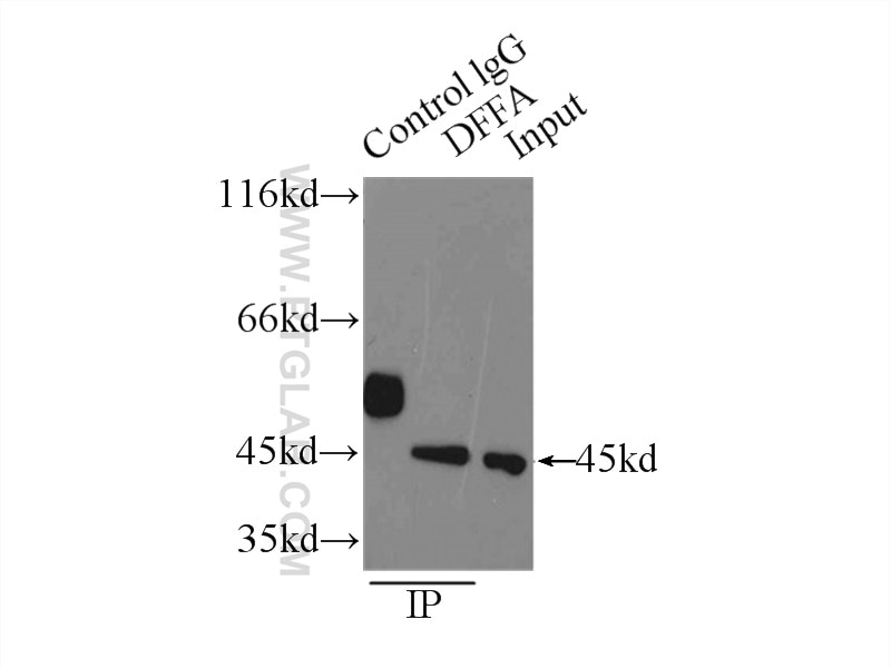 Immunoprecipitation (IP) experiment of HEK-293 cells using DFF45/DFFA Polyclonal antibody (10191-2-AP)