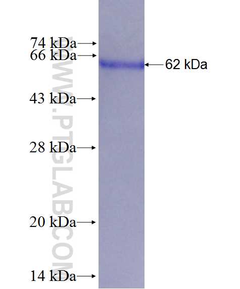 DFFA,DFF45 fusion protein Ag0244 SDS-PAGE
