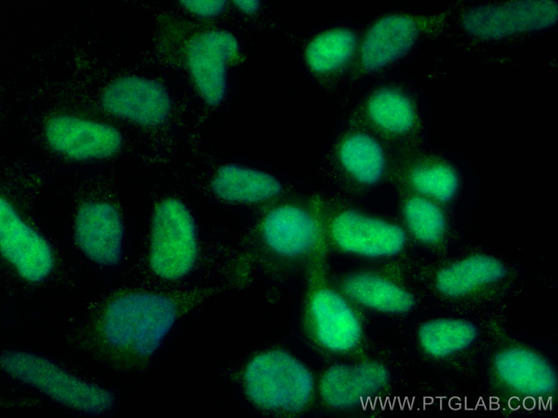 Immunofluorescence (IF) / fluorescent staining of HEK-293 cells using DFFA/DFF45 Monoclonal antibody (68177-1-Ig)