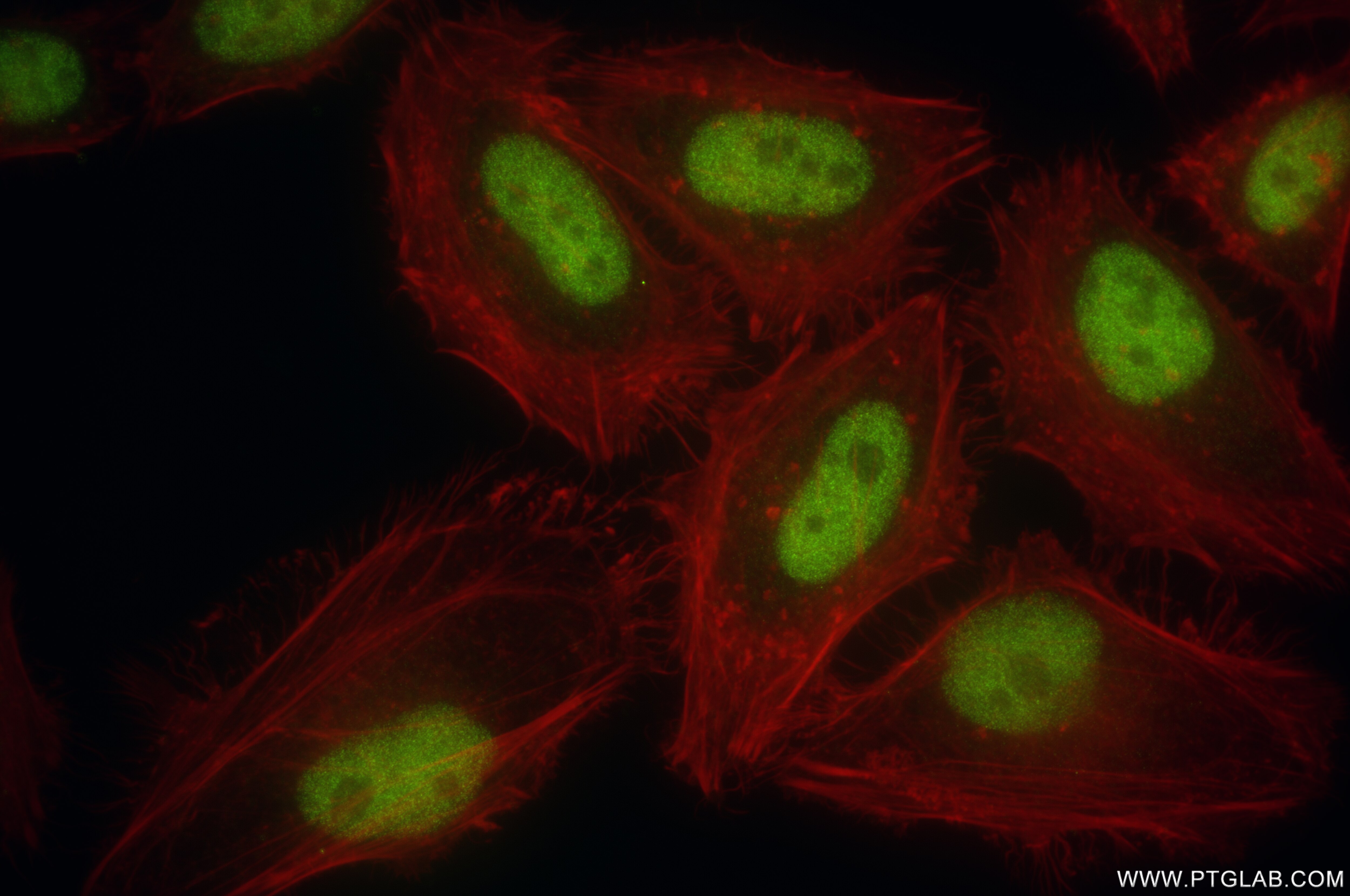Immunofluorescence (IF) / fluorescent staining of HeLa cells using DFFA,DFF45 Recombinant antibody (85220-5-RR)