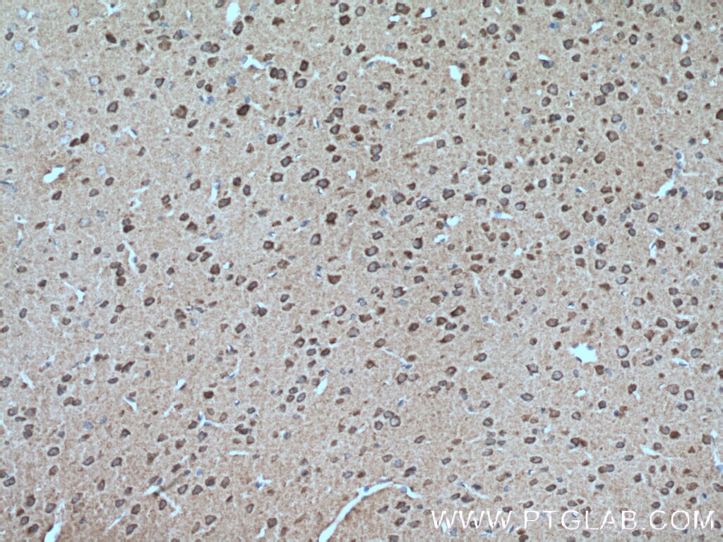 Immunohistochemistry (IHC) staining of mouse brain tissue using DFNA5/GSDME Polyclonal antibody (13075-1-AP)