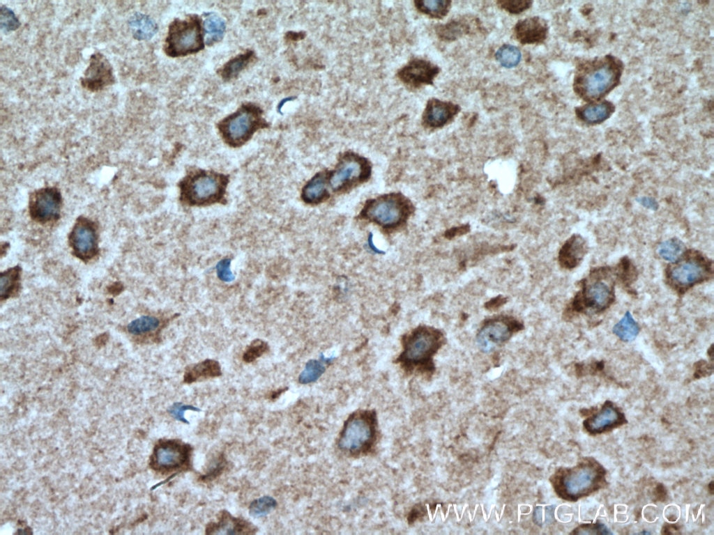 IHC staining of mouse brain using 13075-1-AP