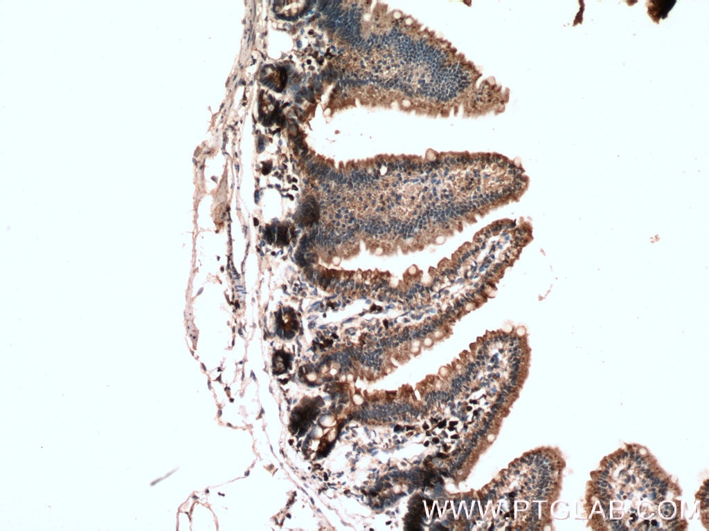 Immunohistochemistry (IHC) staining of mouse small intestine tissue using DFNA5/GSDME Polyclonal antibody (13075-1-AP)