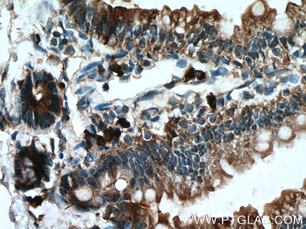 Immunohistochemistry (IHC) staining of mouse small intestine tissue using DFNA5/GSDME Polyclonal antibody (13075-1-AP)