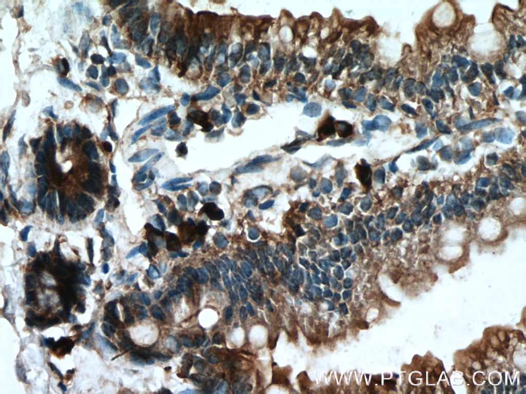 IHC staining of mouse small intestine using 13075-1-AP