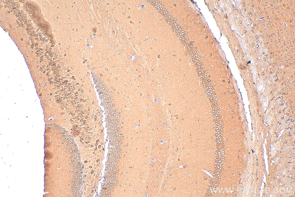 Immunohistochemistry (IHC) staining of mouse brain tissue using DFNA5/GSDME Polyclonal antibody (13075-1-AP)