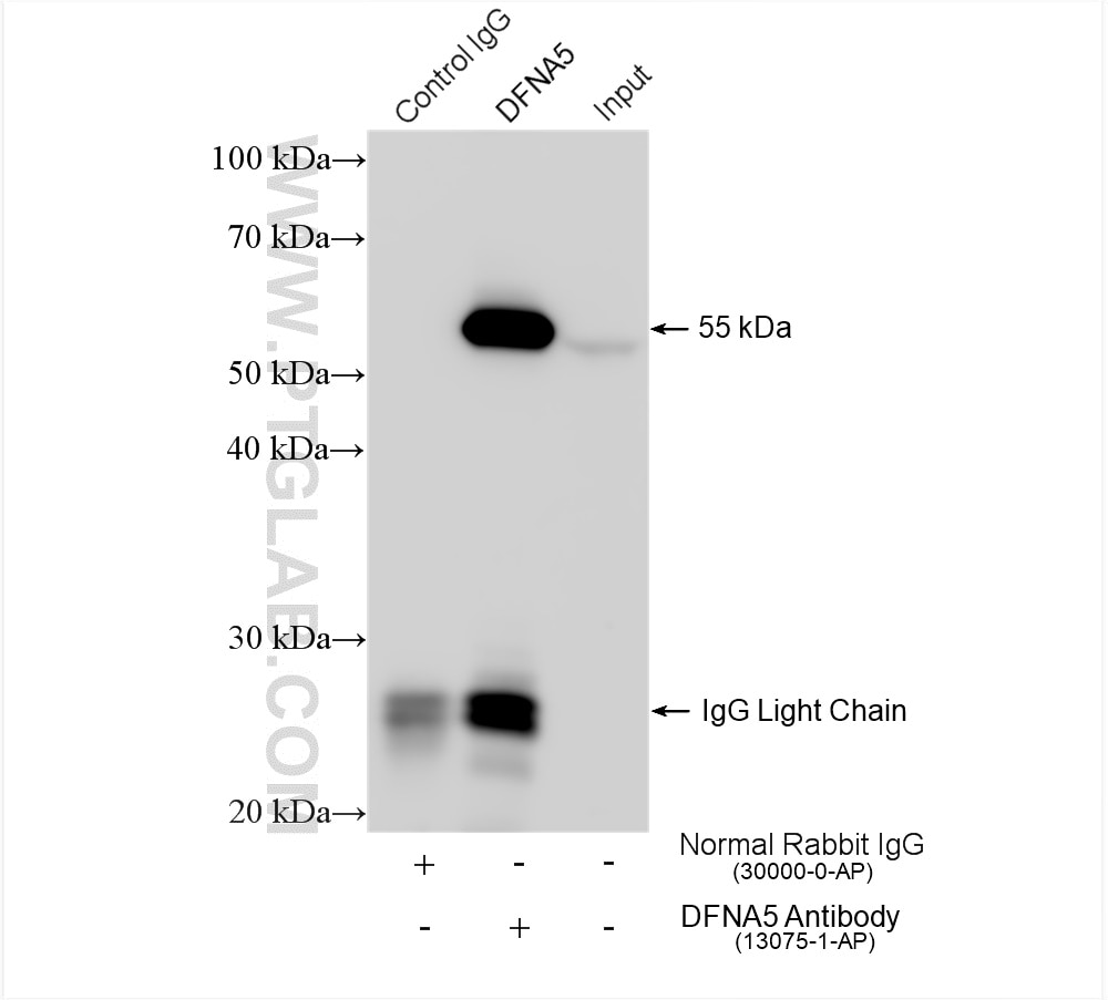 Immunoprecipitation (IP) experiment of SH-SY5Y cells using DFNA5/GSDME Polyclonal antibody (13075-1-AP)