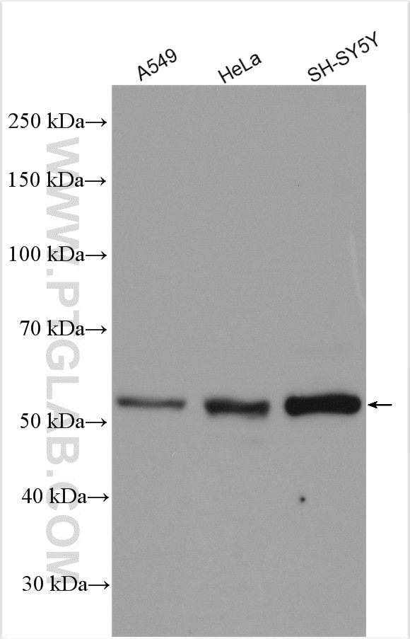 Western Blot (WB) analysis of various lysates using DFNA5/GSDME Polyclonal antibody (13075-1-AP)