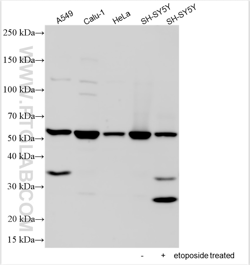 Western Blot (WB) analysis of various lysates using DFNA5/GSDME Polyclonal antibody (13075-1-AP)