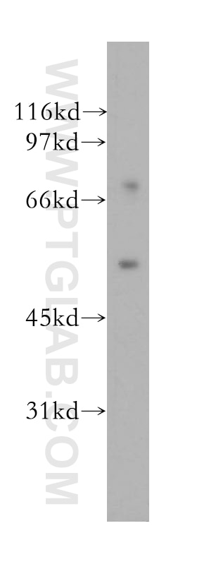 Western Blot (WB) analysis of Y79 cells using DFNA5/GSDME Polyclonal antibody (13075-1-AP)