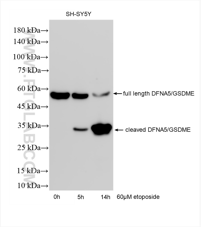 Western Blot (WB) analysis of SH-SY5Y cells using DFNA5/GSDME Recombinant antibody (83454-6-RR)