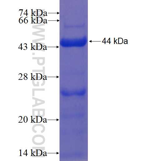 DFNB31 fusion protein Ag22807 SDS-PAGE