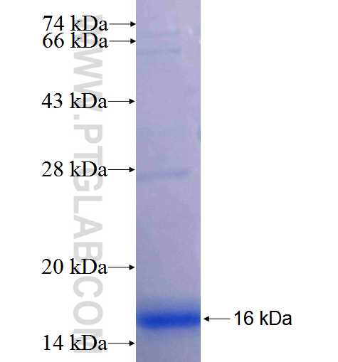 DFNB59 fusion protein Ag24361 SDS-PAGE