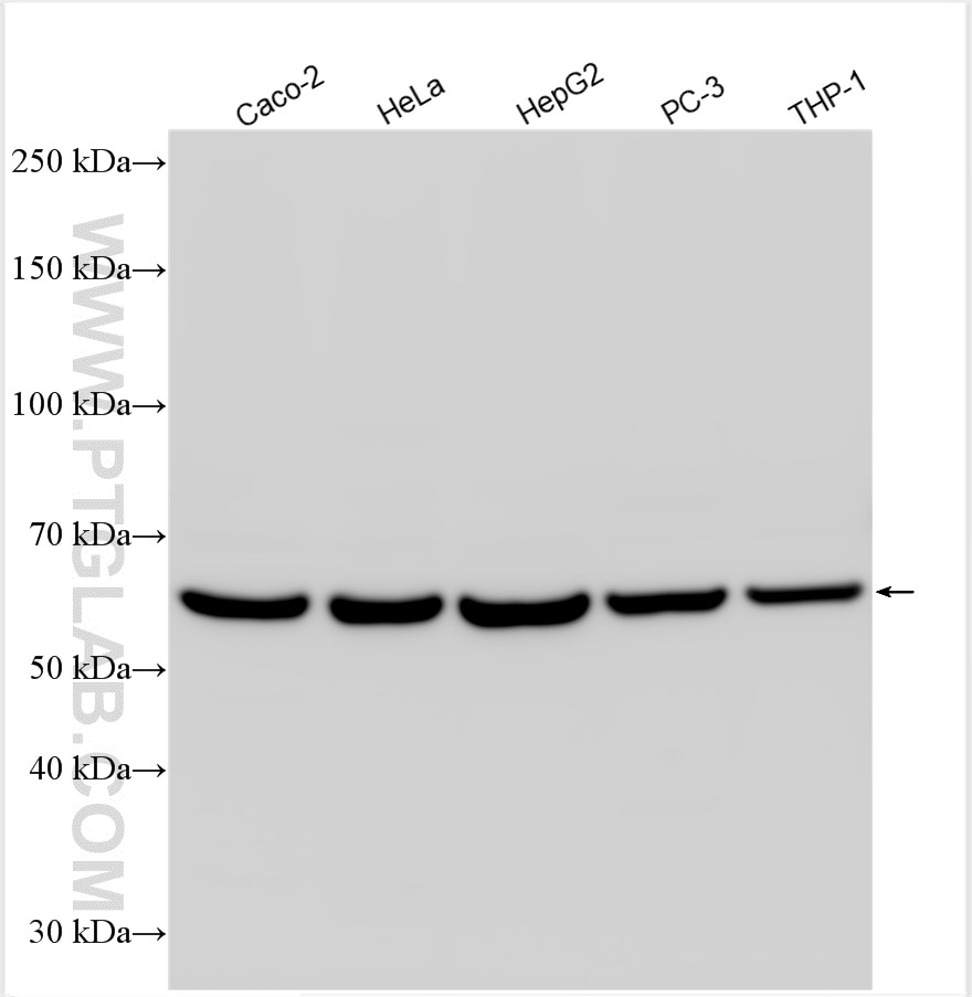 Western Blot (WB) analysis of various lysates using DGAT1 Polyclonal antibody (11561-1-AP)