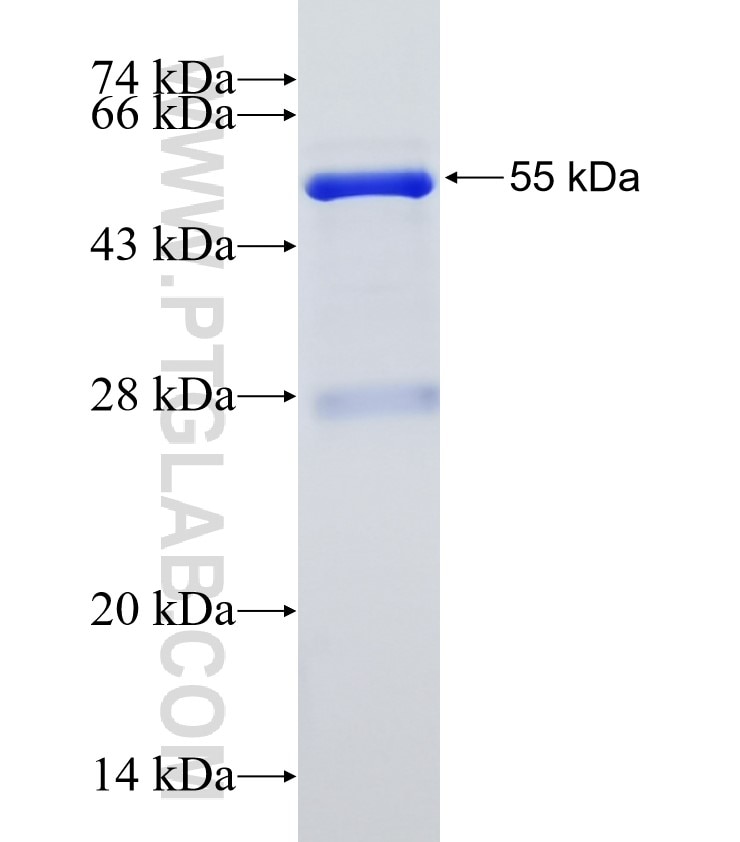 DGAT1 fusion protein Ag2123 SDS-PAGE