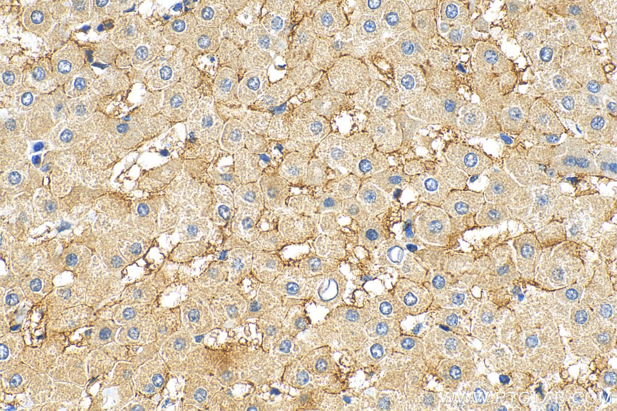 Immunohistochemistry (IHC) staining of human liver tissue using DGAT2 Polyclonal antibody (17100-1-AP)