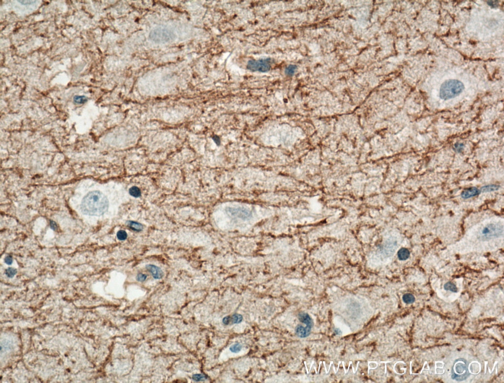 Immunohistochemistry (IHC) staining of human brain tissue using DGCR2 Polyclonal antibody (13705-1-AP)