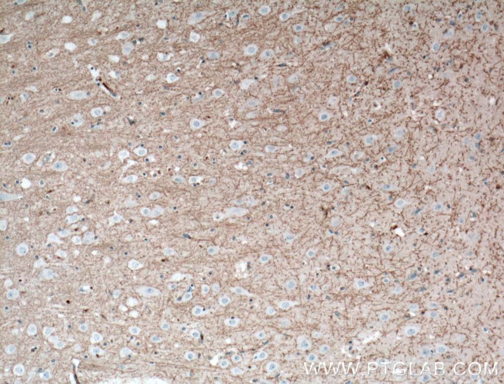 IHC staining of human brain using 13705-1-AP