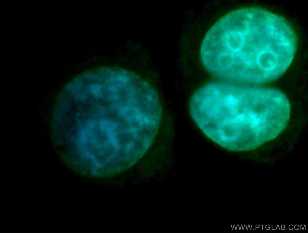 Immunofluorescence (IF) / fluorescent staining of SH-SY5Y cells using DGCR8 C-terminal Polyclonal antibody (10996-1-AP)