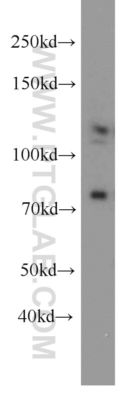 Western Blot (WB) analysis of A431 cells using DGCR8 C-terminal Polyclonal antibody (10996-1-AP)