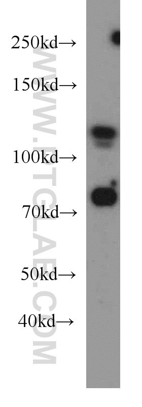 Western Blot (WB) analysis of A431 cells using DGCR8 C-terminal Polyclonal antibody (10996-1-AP)